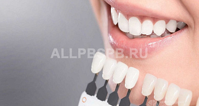Студия отбеливания зубов