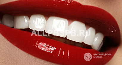 Быстроокупаемая студия отбеливания зубов